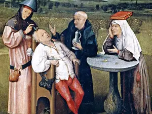 5 Medical Practices Of The Past: Barbaric Or Brilliant?