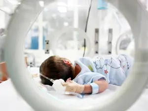 Smallest Baby Ever To Survive Premature Birth